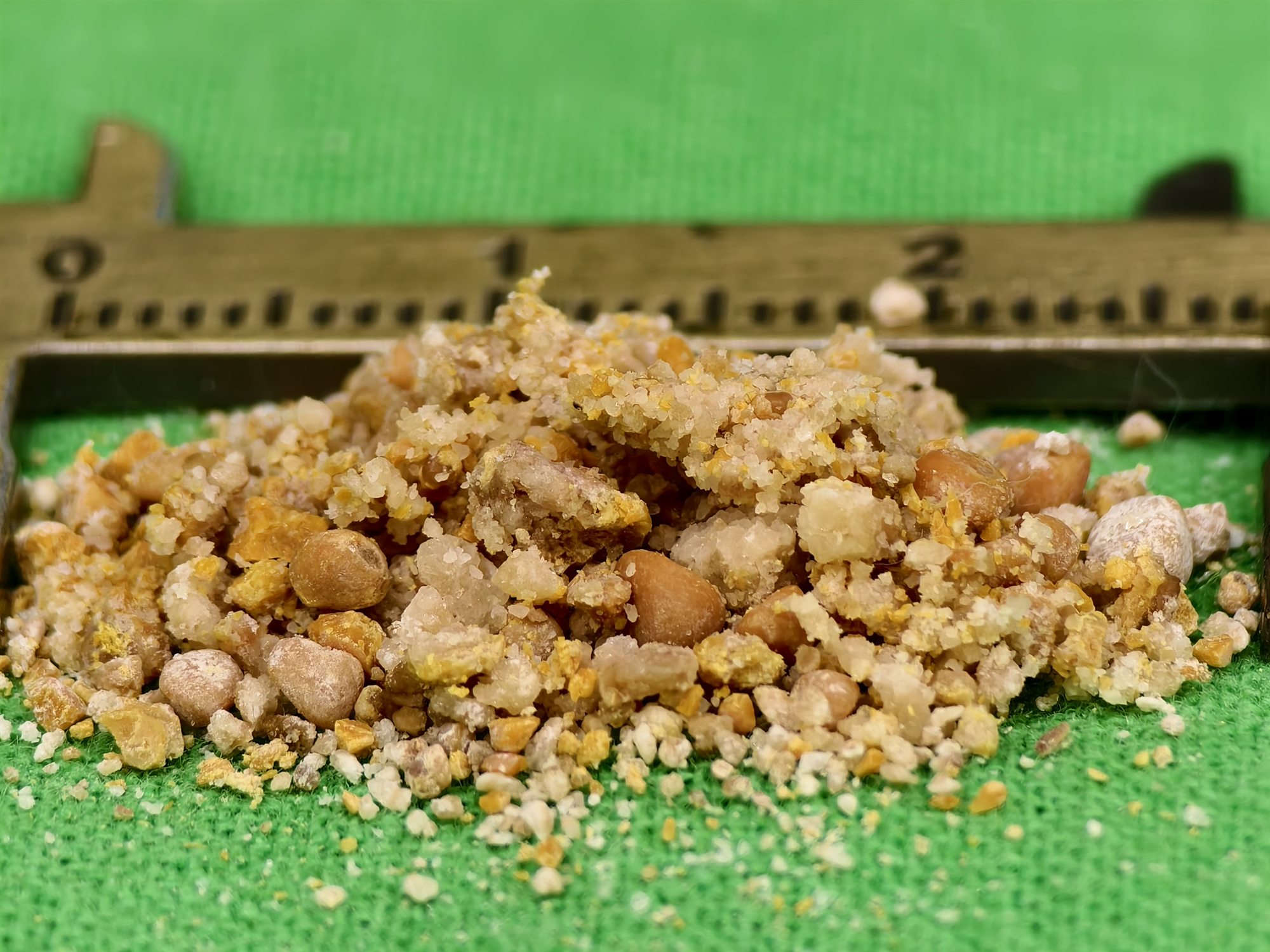 雷射碎石後取出的結石碎片與粉末堆在游標卡尺旁，刻度顯示整堆約兩公分寬，顆粒大小從細沙到米粒不等，顏色有米白與土黃