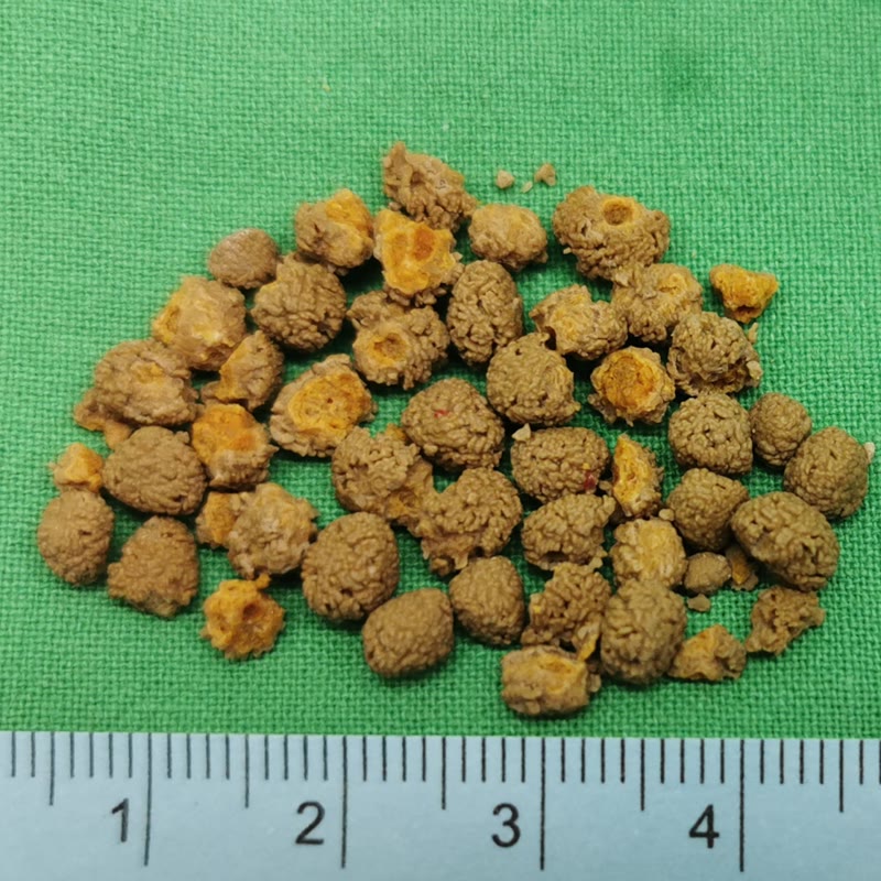 綠色手術鋪單上一堆橘褐色的結石，大約半公分上下，一顆顆圓圓的，下方有公分尺
