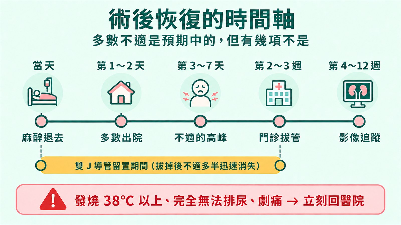 術後恢復時間軸，五個節點由左到右分別是：當天麻醉退去、第一天多數出院、第三到七天不適的高峰、第二到三週門診拔管、第四到十二週影像追蹤；下方以黃色橫條標示雙 J 導管從當天留置到門診拔管，最下方紅色警示列寫著發燒 38 度以上、完全無法排尿、劇痛要立刻回醫院