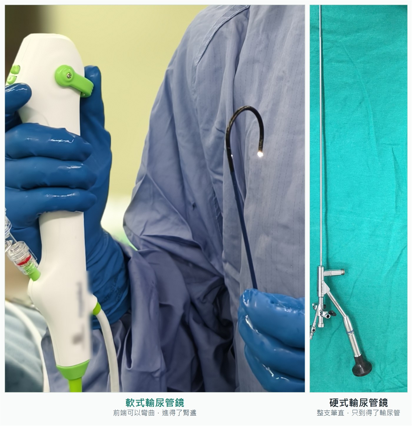 左右兩張實物照片的對照：左邊是手術中戴著手套的手握著軟式輸尿管鏡的白色手柄，細長的黑色鏡身從手柄垂下，前端彎成鉤狀並亮著燈；右邊是放在綠色鋪單上的硬式輸尿管鏡，整支金屬鏡身筆直，下端接著目鏡