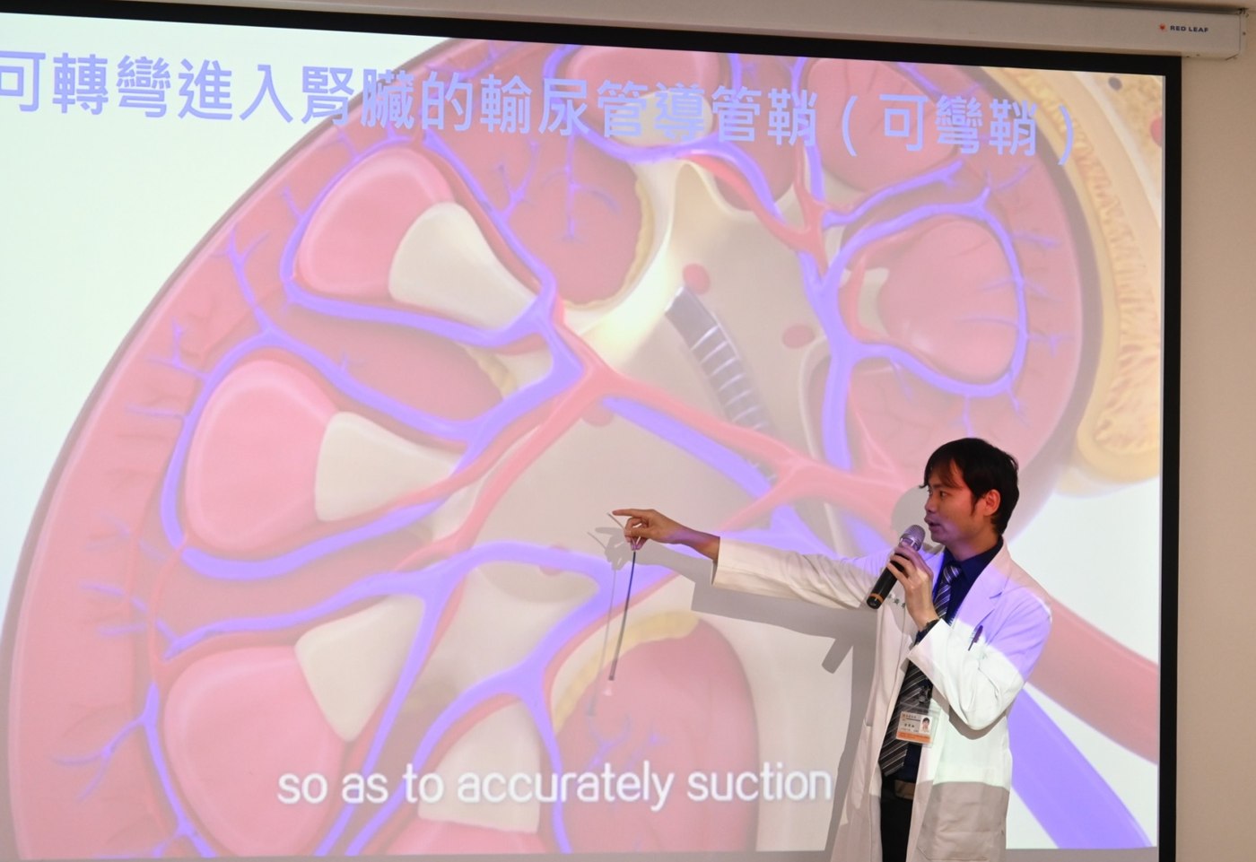 黃韋銘醫師身著白袍手持麥克風，站在投影幕前用雷射筆指著畫面中放大的腎臟剖面示意圖，說明導管鞘如何深入腎盞抽吸碎石，畫面下方有英文字幕 so as to accurately suction