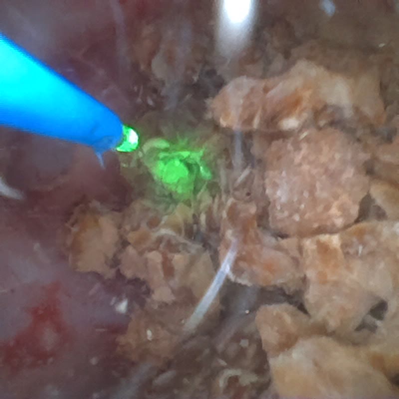 內視鏡畫面，許多大小不一的淺褐色碎塊堆在一起，左上角藍色的雷射光纖打出一團綠色亮光