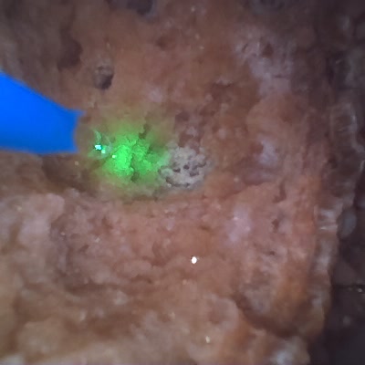 內視鏡畫面，一大片淡橘褐色、表面凹凸不平的結石佔滿畫面，左邊伸進來一支藍色的雷射光纖，前端打在石頭上發出一團綠色亮光