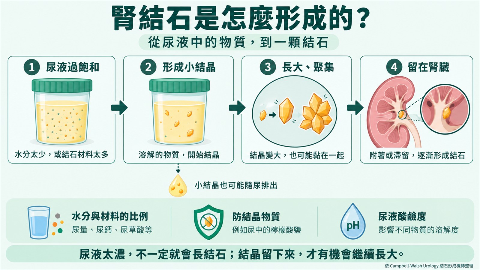 四格流程圖說明腎結石的形成：第一格尿液檢體杯裡漂著許多細小顆粒，標示尿液過飽和、水分太少或結石材料太多；第二格顆粒開始結成小晶體；第三格晶體長大並黏聚成團；第四格腎臟剖面圖中一顆結晶卡在腎盞內逐漸形成結石。下方列出影響因素：水分與材料的比例、尿中的檸檬酸鹽等防結晶物質、尿液酸鹼度