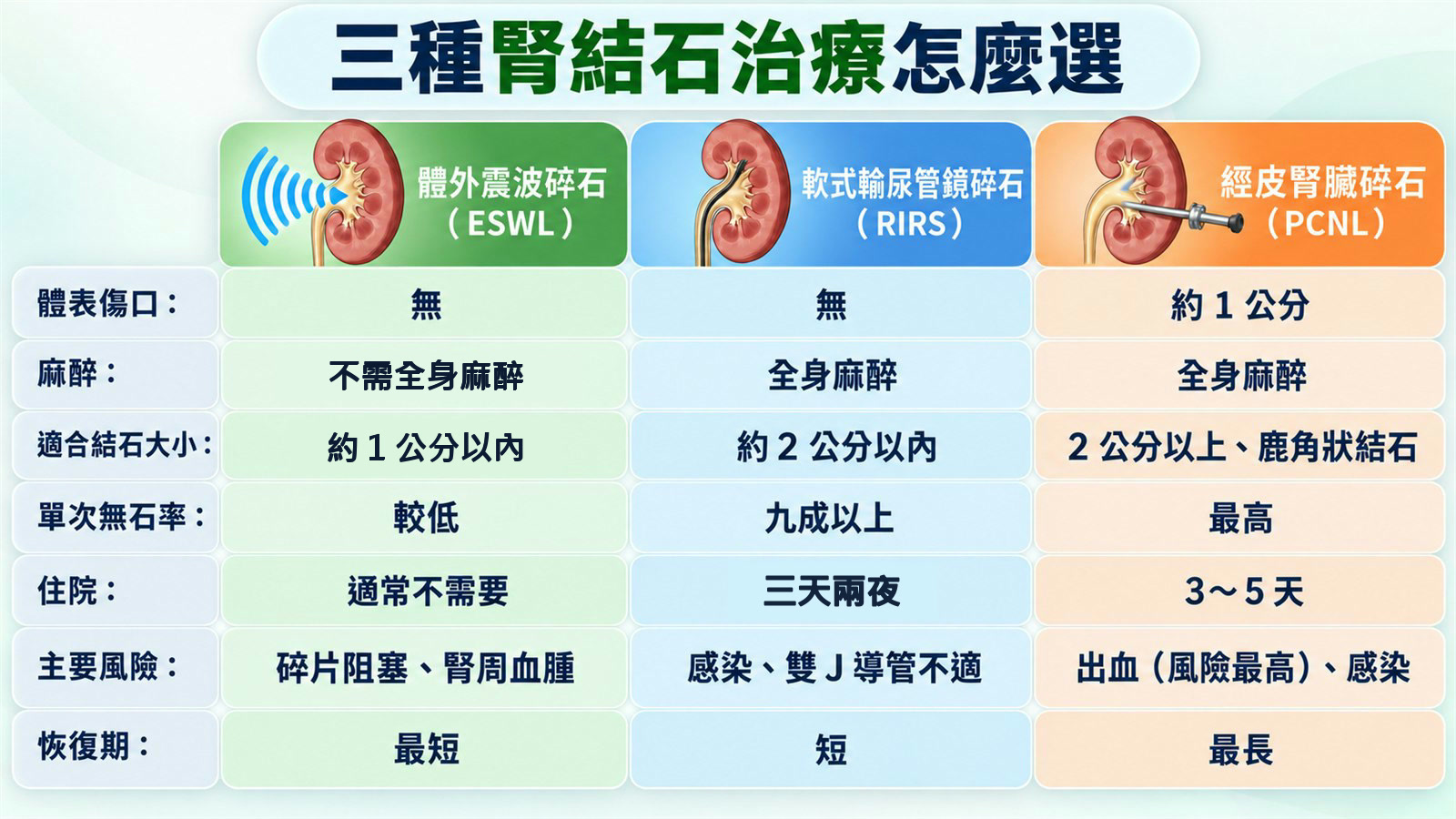 三種腎結石治療方式的對照表：體外震波碎石（ESWL）、軟式輸尿管鏡碎石（RIRS）、經皮腎臟碎石（PCNL），比較體表傷口、麻醉、適合結石大小、單次無石率、住院天數、主要風險與恢復期七個項目