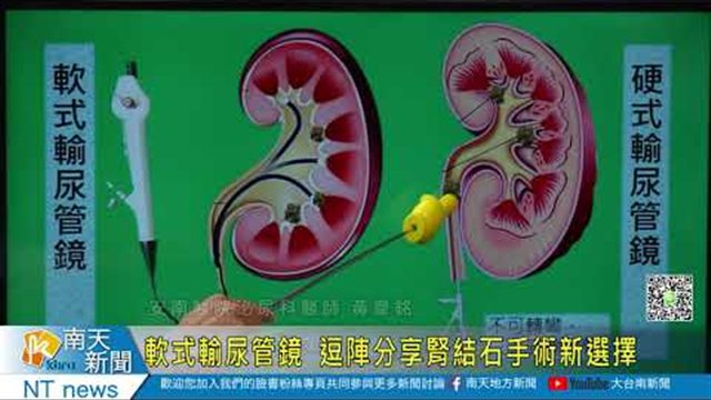 電視節目畫面，腎臟剖面示意圖的兩側分別標示軟式輸尿管鏡與硬式輸尿管鏡，中間畫出導管彎曲進入腎臟的路徑