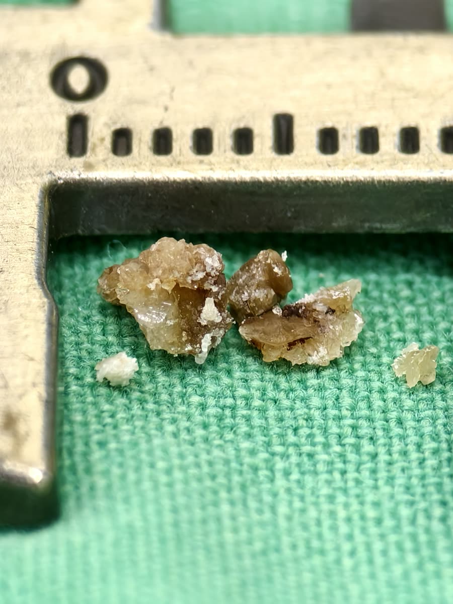 卡尺內幾塊淡褐色、表面布滿小結晶的碎石