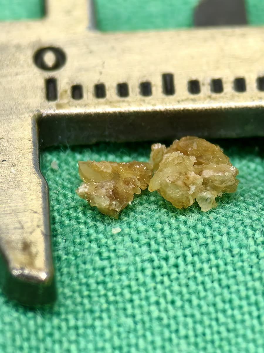 卡尺內兩塊淡黃色、半透明的結晶碎塊